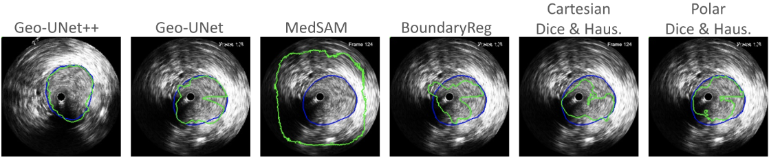 Segmentation example